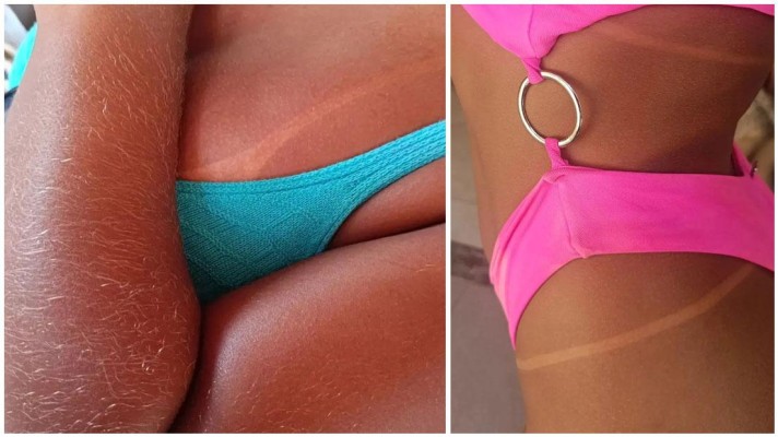 Bronzeamento natural faz mal? Mitos e verdades